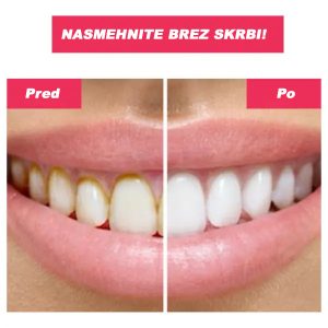 Zobna prha | TOOTHCLEANSO