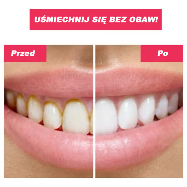 Zobna prha | TOOTHCLEANSO